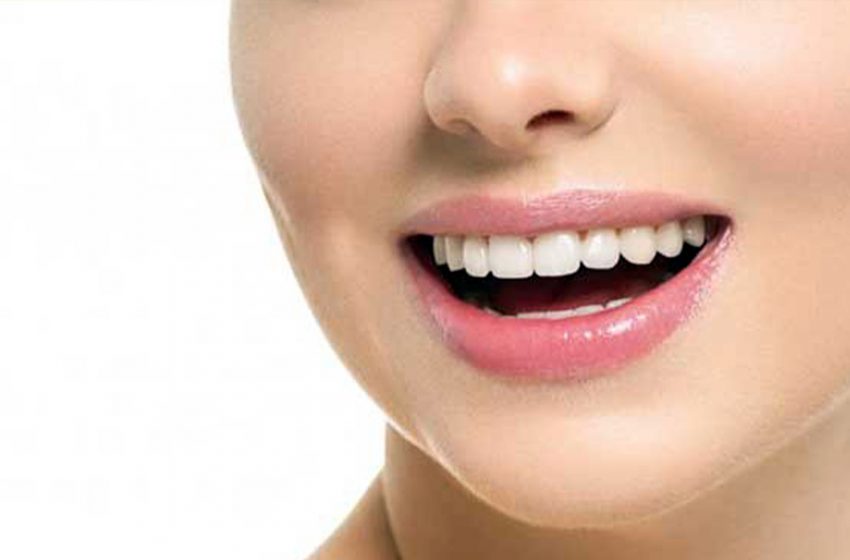  5 Cara Sederhana Memutihkan Gigi Secara Alami