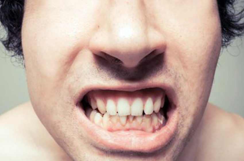  Ketahui Makanan dan Minuman yang Bisa Berdampak Buruk bagi Gigi