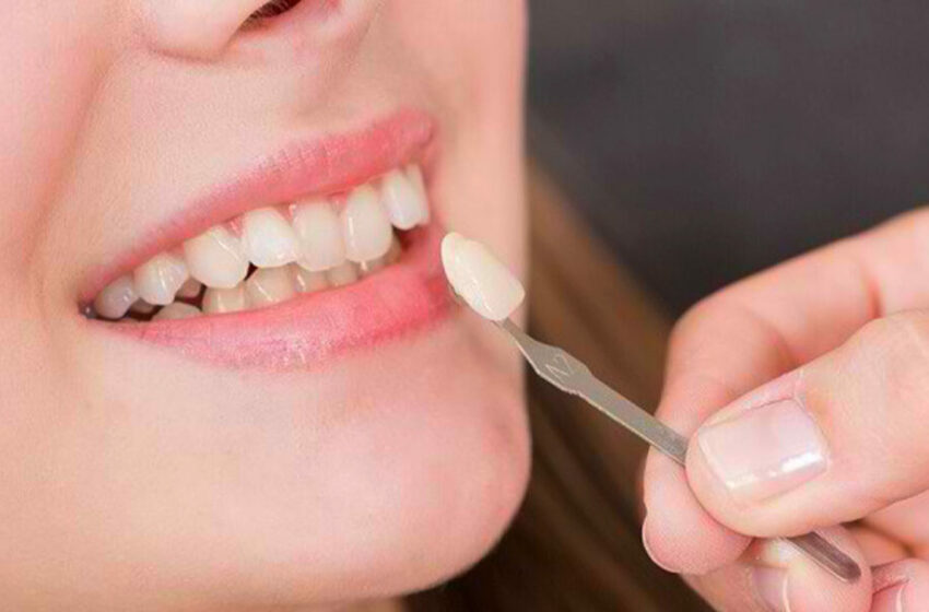  Ketahui Cara Efektif Menghilangkan Gigi Hitam