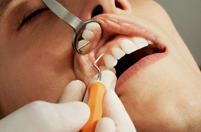  Mengenal Aneka Jenis Perawatan Gigi, Panduan Lengkap untuk Senyum Sehat