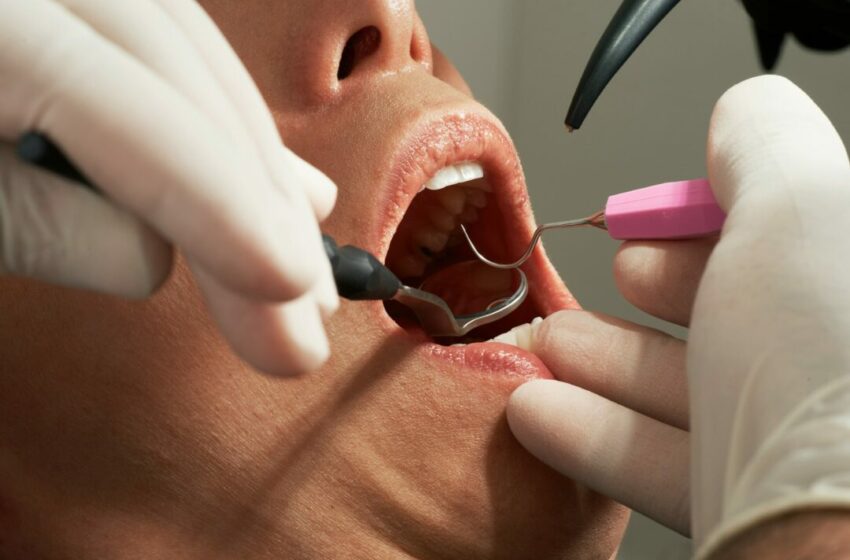  Mengenal Scaling Gigi, Pentingnya Menjaga Kesehatan Gigi dan Mulut