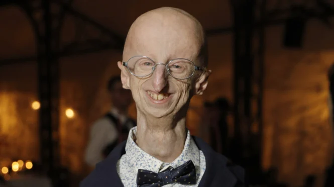  Sammy Basso, Penyintas Progeria Terlama, Meninggal di Usia 28 Tahun