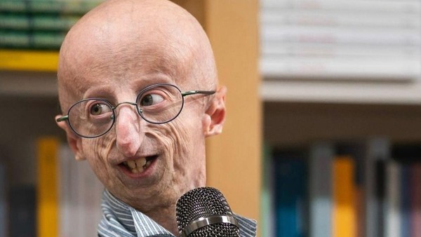  Sammy Basso, Ilmuwan Progeria yang Selalu Tersenyum, Meninggal Dunia